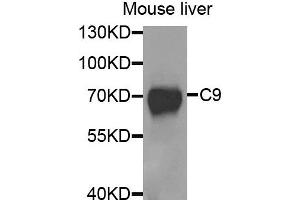 Western blot analysis of extracts of mouse liver, using C9 antibody. (C9 抗体)