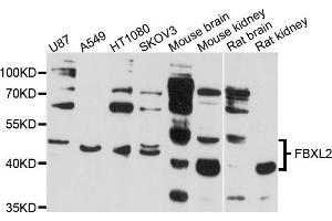 Western blot analysis of extract of various cells, using FBXL2 antibody. (FBXL2 抗体)
