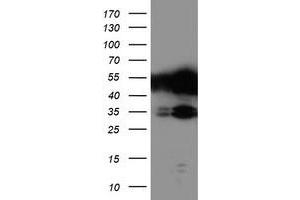 Western Blotting (WB) image for anti-T-Cell Acute Lymphocytic Leukemia 1 (TAL1) antibody (ABIN1501290) (TAL1 抗体)