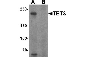 Western blot analysis of TET3 in SK-N-SH cell lysate with TET3 antibody at 1 µg/mL in (A) the absence and (B) the presence of blocking peptide. (TET3 抗体  (C-Term))