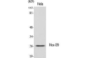Western Blot analysis of various cells using Hox-B9 Polyclonal Antibody diluted at 1:1000. (HOXB9 抗体  (AA 180-260))