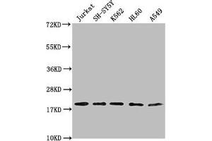 Western Blot Positive WB detected in: Jurkat whole cell lysate, SH-SY5Y whole cell lysate, K562 whole cell lysate, HL-60 whole cell lysate, A549 whole cell lysate All lanes: RPL24 antibody at 1:2000 Secondary Goat polyclonal to rabbit IgG at 1/50000 dilution Predicted band size: 18 kDa Observed band size: 18 kDa (RPL24 抗体  (AA 1-157))