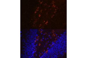 Immunofluorescence analysis of mouse brain using Phospho-Tau-T231 antibody (ABIN7268531). (MAPT 抗体  (pThr231))