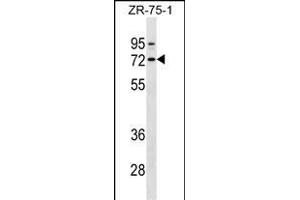 SELE Antibody (Ascites) ABIN1539992 western blot analysis in ZR-75-1 cell line lysates (35 μg/lane). (Selectin E/CD62e 抗体)