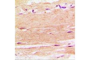 Immunohistochemistry (IHC) image for anti-Sphingosine Kinase 1 (SPHK1) antibody (ABIN7308364) (SPHK1 抗体)