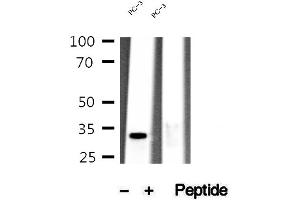 Western blot analysis of extracts of PC-3 cells, using MEST antibody. (MEST 抗体  (C-Term))