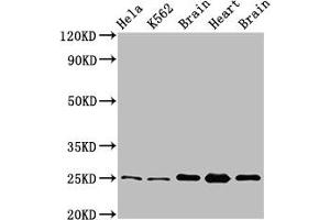 Western Blot Positive WB detected in: Hela whole cell lysate, K562 whole cell lysate, Rat brain tissue, Rat heart tissue, Mouse brain tissu All lanes: SOD2 antibody at 3. (SOD2 抗体  (AA 64-175))