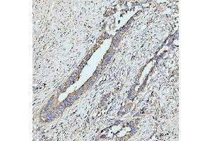 IHC analysis of GRPEL1 using anti-GRPEL1 antibody (ABIN7602643). (GRPEL1 抗体  (AA 90-217))