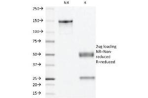 SDS-PAGE Analysis Purified PR Monoclonal Antibody (PR501). (Progesterone Receptor 抗体)
