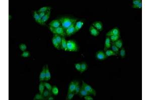 Immunofluorescence staining of HepG2 cells with ABIN7175834 at 1:166, counter-stained with DAPI. (WASF2 抗体  (AA 243-317))