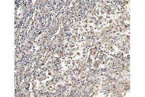 IHC analysis of Aldolase/ALDOA using anti-Aldolase/ALDOA antibody (ABIN7601908). (ALDOA 抗体  (AA 50-364))