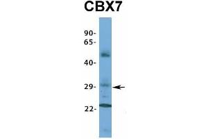 Host:  Rabbit  Target Name:  CBX7  Sample Type:  Human Fetal Muscle  Antibody Dilution:  1. (CBX7 抗体  (Middle Region))