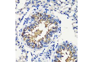 Immunohistochemistry of paraffin-embedded mouse lung using FKBP12 antibody (ABIN3022503, ABIN3022504, ABIN3022505 and ABIN6218864) at dilution of 1:200 (40x lens). (FKBP1A 抗体  (AA 1-108))