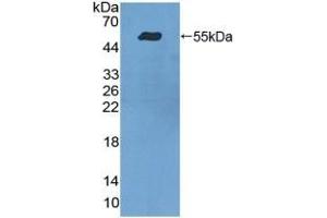 Detection of Recombinant ITGa9, Human using Polyclonal Antibody to Integrin Alpha 9 (ITGa9) (ITGA9 抗体  (AA 741-965))