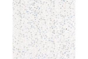 Immunohistochemistry (IHC) image for anti-Replication Protein A2, 32kDa (RPA2) (C-Term) antibody (ABIN7454599)