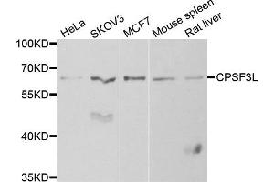 Western blot analysis of extracts of various cell lines, using CPSF3L antibody. (CPSF3L 抗体)