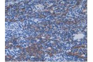 IHC-P analysis of Mouse Ovary Tissue, with DAB staining. (IL13RA2 抗体  (AA 228-338))