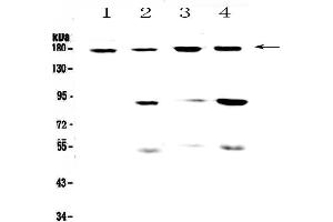 Western blot analysis of CD11b using anti-CD11b antibody . (CD11b 抗体  (AA 129-336))