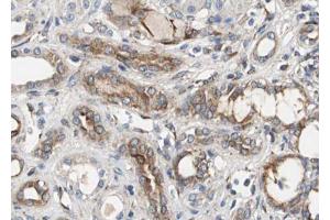 ABIN6267492 at 1/100 staining human Kidney tissue sections by IHC-P. (VEGFR2/CD309 抗体  (pTyr951))