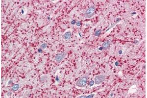 Human Brain, Cortex (formalin-fixed, paraffin-embedded) stained with MOG antibody ABIN337146 at 5 ug/ml followed by biotinylated anti-goat IgG secondary antibody ABIN481715, alkaline phosphatase-streptavidin and chromogen. (MOG 抗体  (AA 248-259))