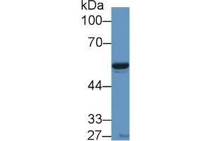 Western Blotting (WB) image for anti-Nicotinamide phosphoribosyltransferase (NAMPT) (AA 1-491) antibody (ABIN7432295)