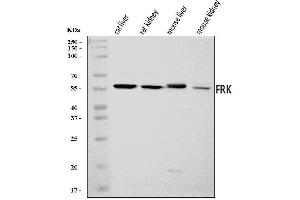 Western blot analysis of FRK using anti-FRK antibody (ABIN7601577).