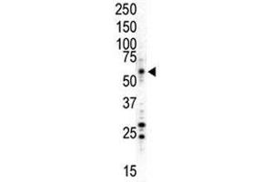 Western Blotting (WB) image for anti-Mitogen-Activated Protein Kinase 8 (MAPK8) (AA 358-389) antibody (ABIN3031837)