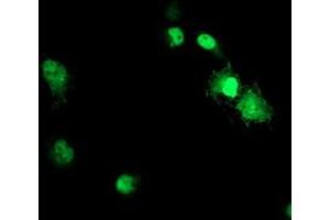 Anti-ACD mouse monoclonal antibody (ABIN2455628) immunofluorescent staining of COS7 cells transiently transfected by pCMV6-ENTRY ACD (RC204381). (ACD 抗体)