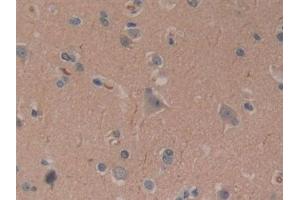 Detection of CYLD in Human Brain Tissue using Polyclonal Antibody to Cylindromatosis (CYLD) (CYLD 抗体  (AA 170-338))