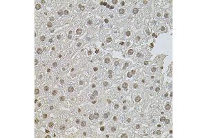 Immunohistochemistry of paraffin-embedded mouse liver using ZNF408 antibody. (ZNF408 抗体)