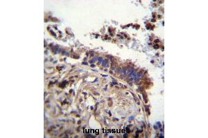 TTBK2 Antibody (N-term) immunohistochemistry analysis in formalin fixed and paraffin embedded human lung tissue followed by peroxidase conjugation of the secondary antibody and DAB staining. (TTBK2 抗体  (N-Term))