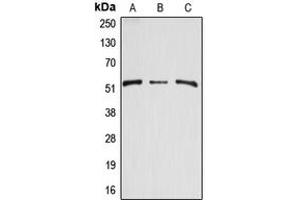 Western blot analysis of Arylsulfatase A expression in HEK293T (A), mouse kidney (B), rat kidney (C) whole cell lysates. (Arylsulfatase A 抗体  (Center))