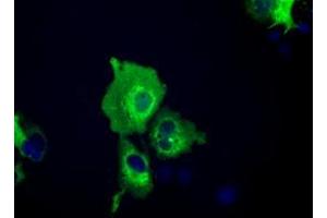 Image no. 6 for anti-Insulin-Like Growth Factor 2 mRNA Binding Protein 2 (IGF2BP2) antibody (ABIN1498821)