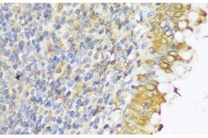 Immunohistochemistry of paraffin-embedded Human appendix using GLB1L3 Polyclonal Antibody at dilution of 1:150 (40x lens). (GLB1L3 抗体)