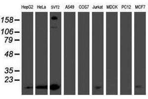 Image no. 1 for anti-Phosphomevalonate Kinase (PMVK) antibody (ABIN1500303) (PMVK 抗体)