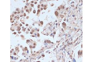 Immunohistochemistry (Paraffin-embedded Sections) (IHC (p)) image for anti-Protein Kinase, AMP-Activated, alpha 1 Catalytic Subunit (PRKAA1) (pThr172), (pThr183) antibody (ABIN7265094)