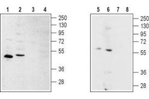 Western blot analysis of rat kidney (lanes 1 and 3), rat heart (lanes 2 and 4), human SH-SY5Y brain neuroblastoma (lanes 5 and 7) and Human MS-1  neuroendocrine skin carcinoma cell (lanes 6 and 8) lysates: - 1,2,5,6. (S1PR2 抗体  (2nd Cytoplasmic Loop))