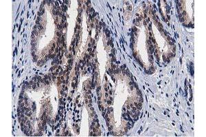 Image no. 4 for anti-Transforming, Acidic Coiled-Coil Containing Protein 3 (TACC3) antibody (ABIN1498095) (TACC3 抗体)