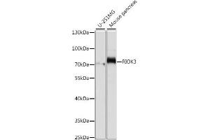 Western blot analysis of extracts of various cell lines, using RIOK3 antibody (ABIN7270112) at 1:1000 dilution. (RIOK3 抗体  (AA 200-519))