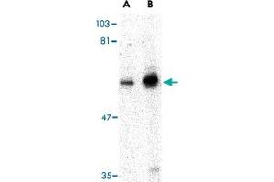 Western blot analysis of PTPN11 in mouse skeletal muscle tissue lysate with PTPN11 polyclonal antibody  at (A) 0.