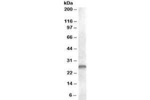 Western blot testing of human kidney lysate with CLEC1B antibody at 1ug/ml. (C-Type Lectin Domain Family 1, Member B (CLEC1B) 抗体)