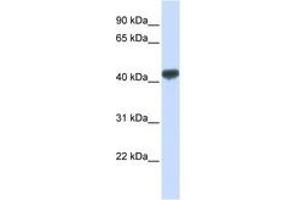 Image no. 1 for anti-Zinc Finger Protein 265 (Zranb2) (AA 72-121) antibody (ABIN6740510) (ZNF265 抗体  (AA 72-121))