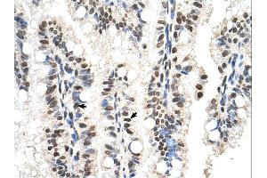 RUNDC2A antibody was used for immunohistochemistry at a concentration of 4-8 ug/ml. (SNX29 抗体  (N-Term))