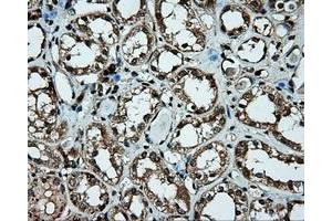 Immunohistochemical staining of paraffin-embedded liver tissue using anti-PLEK mouse monoclonal antibody. (Pleckstrin 抗体)
