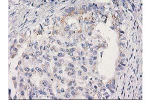 Image no. 1 for anti-Mitochondrial Ribosomal Protein S2 (MRPS2) antibody (ABIN1499562) (MRPS2 抗体)