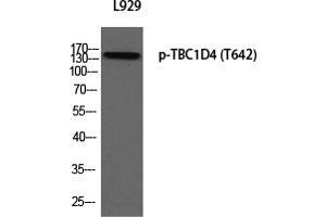 Western Blotting (WB) image for anti-TBC1 Domain Family, Member 4 (TBC1D4) (pThr642) antibody (ABIN5955761) (TBC1D4 抗体  (pThr642))