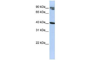WB Suggested Anti-KLHDC8A Antibody Titration:  0. (KLHDC8A 抗体  (Middle Region))