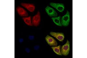 TBCE Antibody staining Hela cells by IF/ICC. (TBCE 抗体  (N-Term))