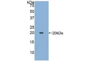 Detection of Recombinant ECP, Human using Polyclonal Antibody to Ecotin (ECO) (Ecotin (AA 21-162) 抗体)