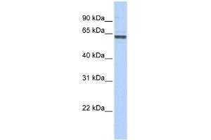 RNMT antibody used at 1 ug/ml to detect target protein. (RNMT 抗体)